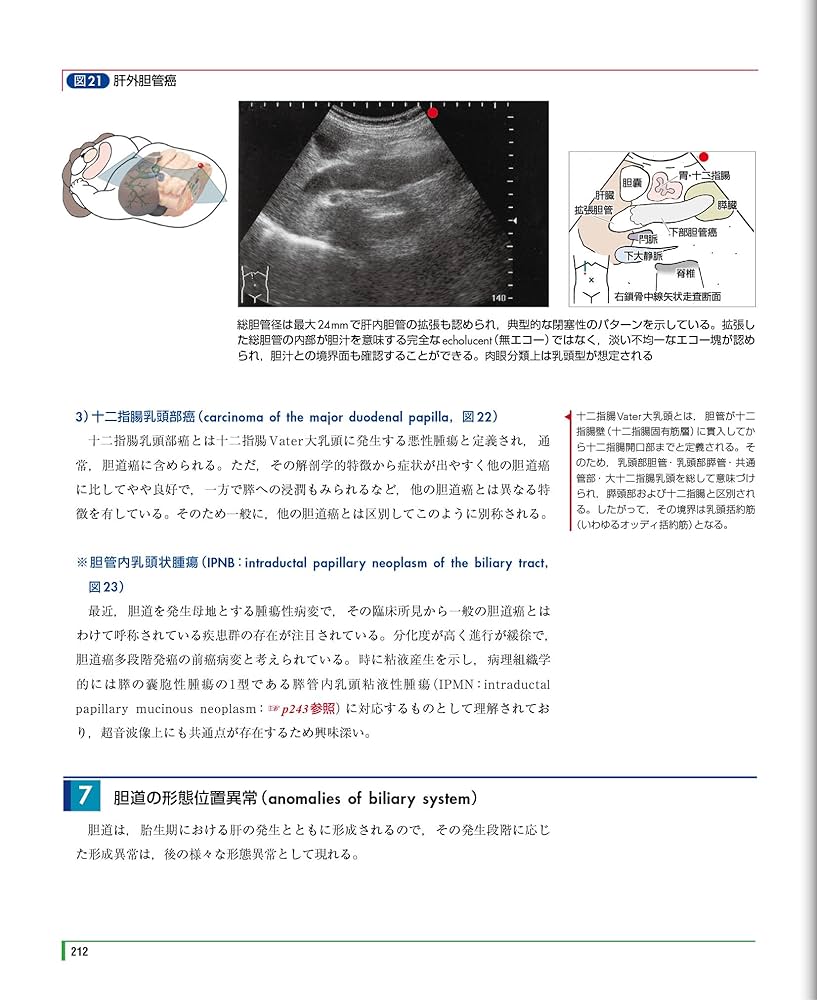 できるゾ読めるゾ腹部エコー   ３版/日本医事新報社/朝井均（単行本） できるゾ読めるゾ 腹部エコー | 中村 滋, 朝井 均 |本 | 通販
